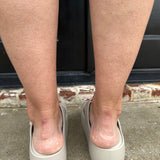 Melissa Free Line Platform Slide Sandals